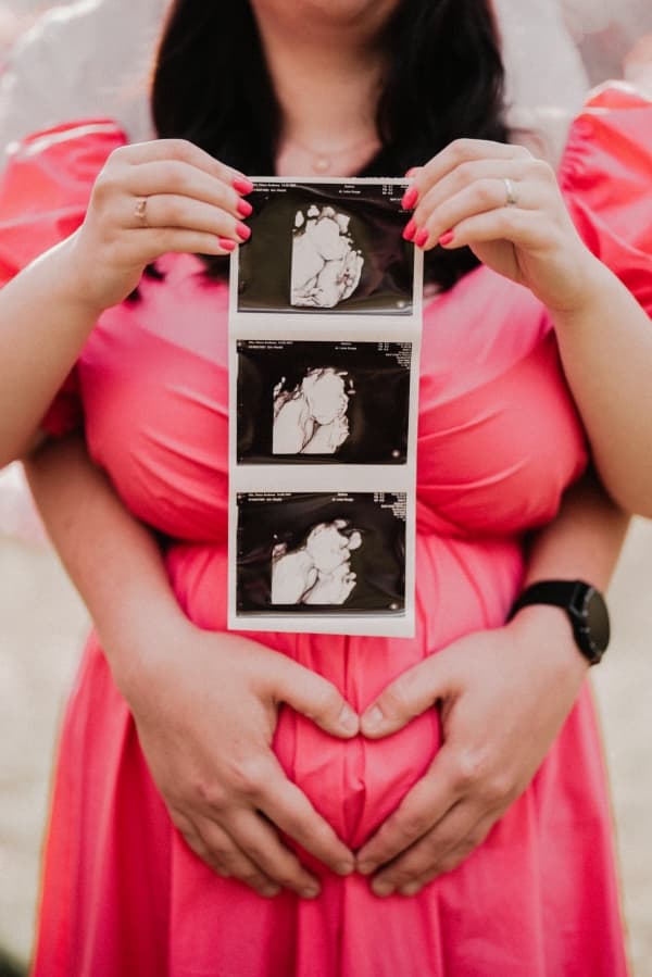 Fotografie de Studio Pozici la Gradina Japoneza